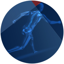 Orthopedics INSTRUMENT